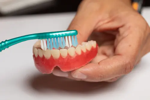 Cleaning Snap-On - Impressions Dental