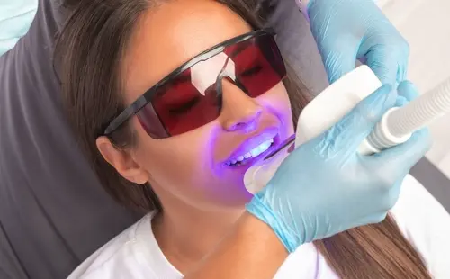 Get Professional Teeth-Whitening from Your Chandler Dentist - Impressions Dental