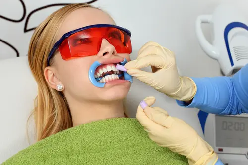 How Zoom Teeth Whitening Works - Impressions Dental
