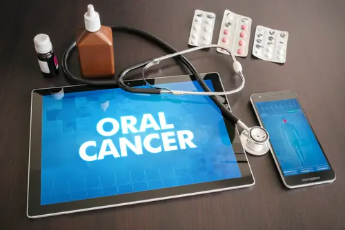 Is it Common to Have an Oral Cancer Screening - Impressions Dental