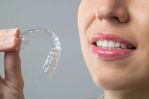 Levels of ImpressAlign Clear Aligners - Impressions Dental