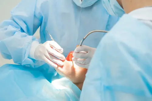 Oral Surgery - At Impressions Dental