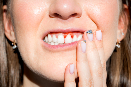 Periodontics - Impressions Dental Can Help