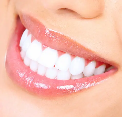 Professional Teeth Whitening - At Impressions Dental