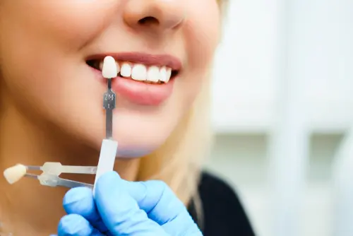 Same Day Dentistry and Dental Crowns - Impressions Dental