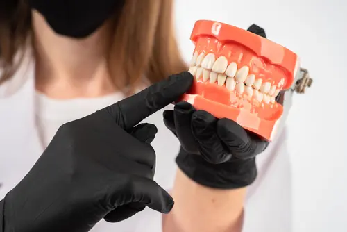 The Denture Process - Impressions Dental Show You the Steps