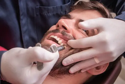 Types of Sedation Dentistry - Impressions Dental