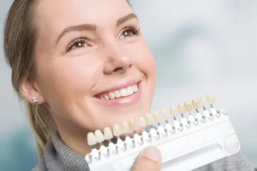What You Need to Know About Teeth Whitening - Impressions Dental