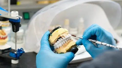 What is a Prosthodontist - Impressions Dental
