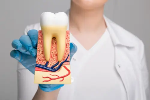 Why Should I have a Root Canal Treatment - Impressions Dental Will Tell You Why