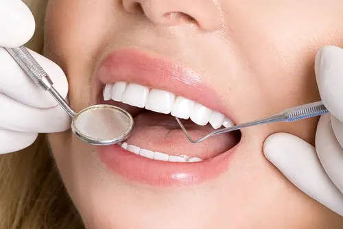 Why Snap-On Smiles - Impressions Dental