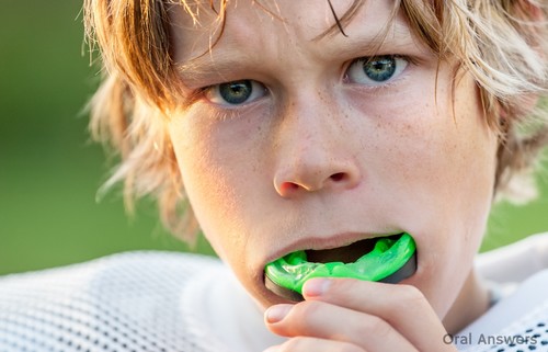 High School Mouthguards