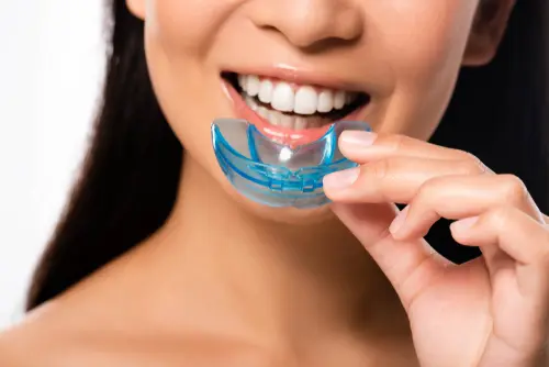 Extra Protection for Your Teeth - Impressions Dental