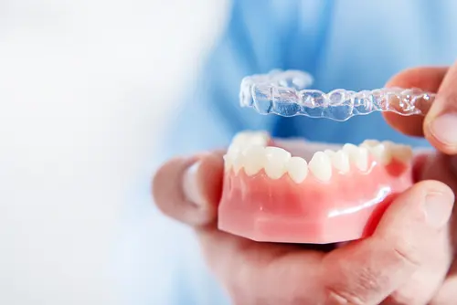 How Does Invisalign Work - Impresions Dental