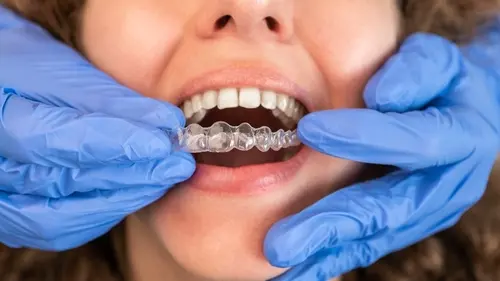 Invisalign Dentist - AT Impressions Dental