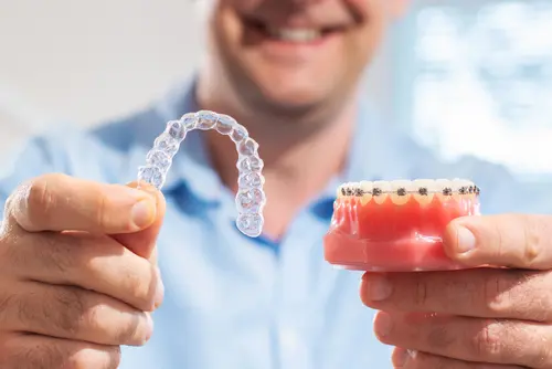 Invisalign or Traditional Braces - Impressions Dental