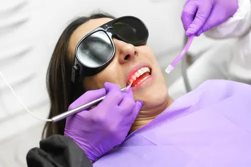 Laser Dentistry - Impressions Dental