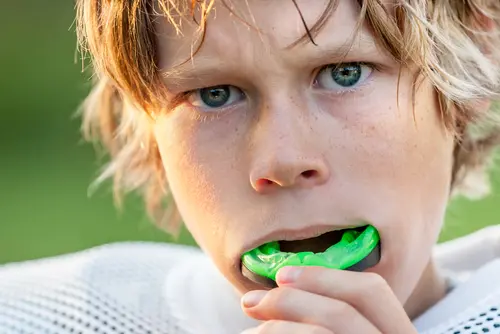 Mouth Guards - Impressions Dental