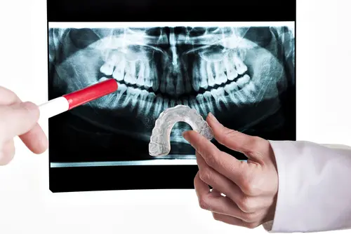 Reason Why You Should Have One created by a Dentist - Impressions Dental