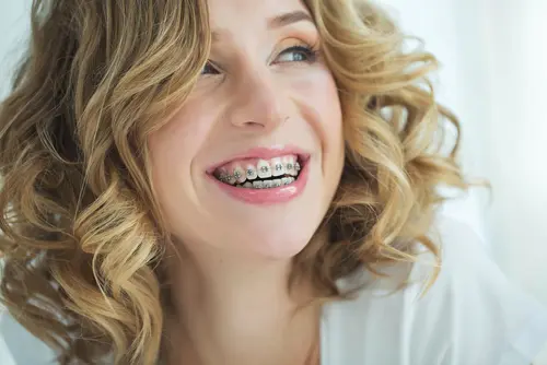 The Reality of Traditional Braces - Impressions Dental