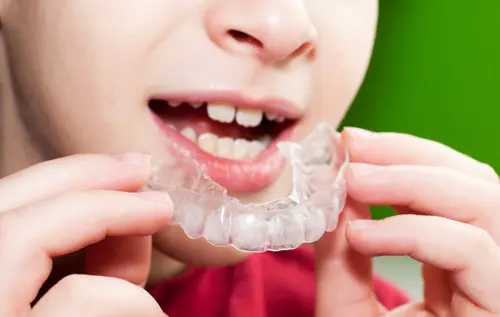 What is the Risk of Not Wearing a Mouth Guard - Impressions Dental
