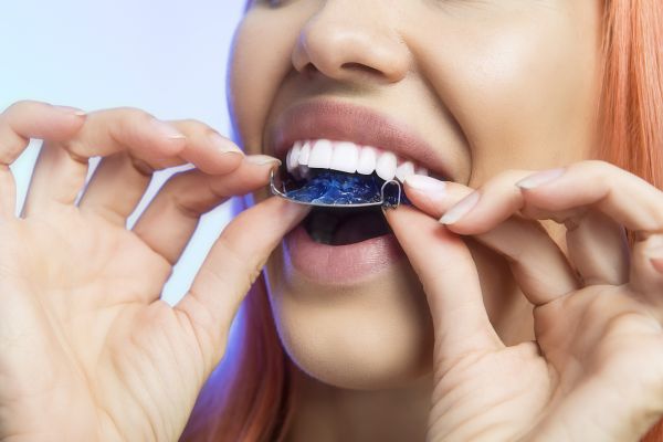 Your A-Z Guide to Invisible Braces for Teeth