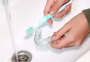 Cleaning Invisalign - Impressions Dental